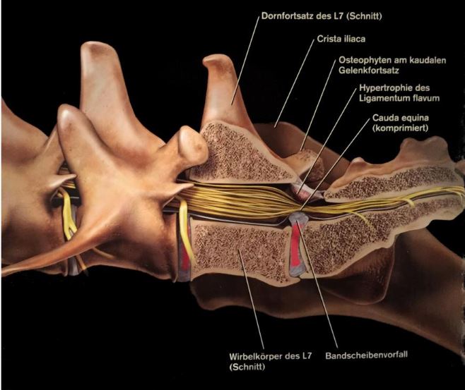 LÜW Schaltwirbel / Lumbosakralen Übergangswirbel Das Schäferhund Forum